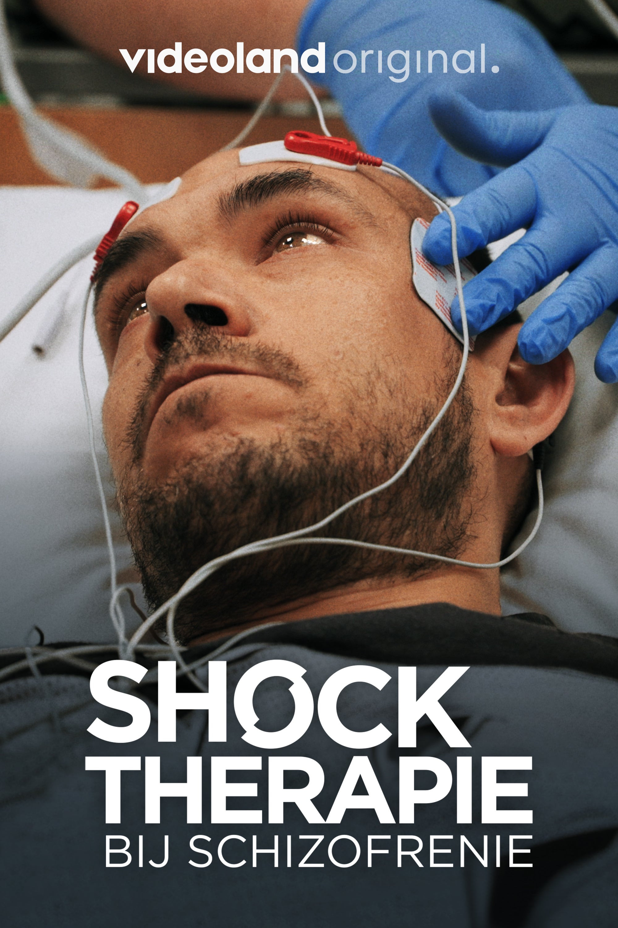 Shocktherapie Bij Schizofrenie