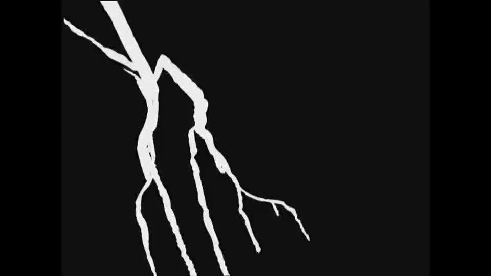 Jacob Dubbel En De Onaanlokkelijke Spuuglok