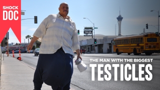 Shock Doc: The Man With The Biggest Testicles