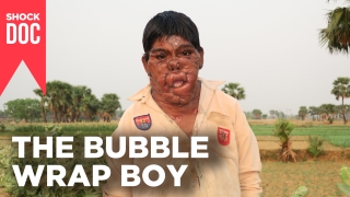 Shock Doc: The Bubble Wrap Boy