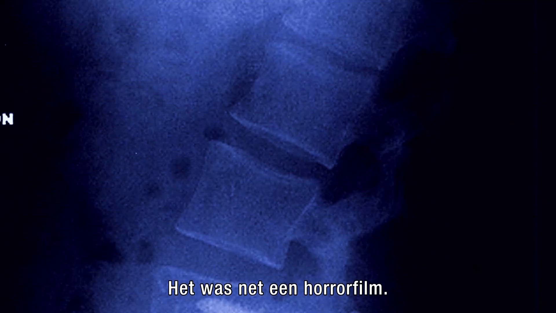 Trailer: Dr. Death: The Undoctored Story